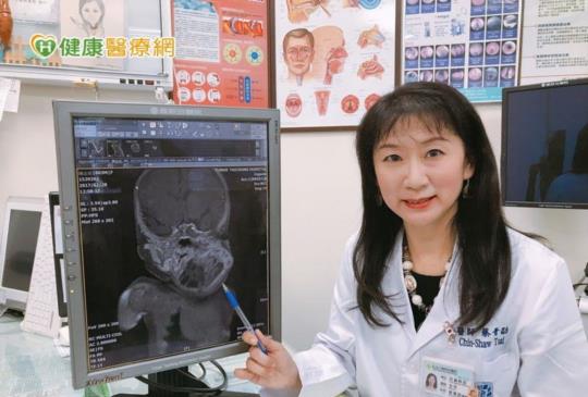 罕見頸畸胎瘤恐致命？ 醫籲及早治療勿拖延