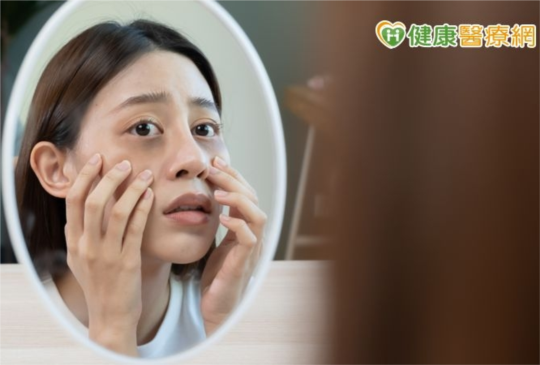別讓眼睛透露出你有多累　眼周針灸可消除疲勞又減齡