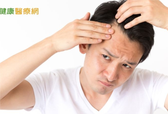 髮際線上移好困擾　四體質專業中醫一一破解