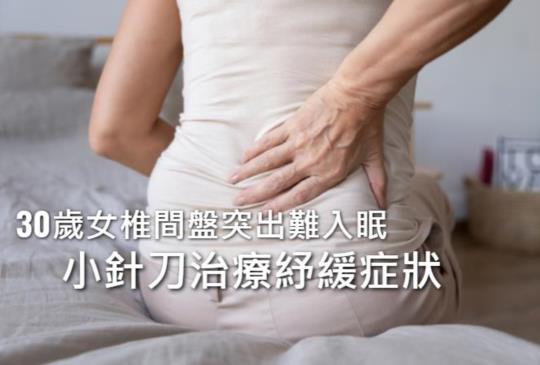 椎間盤突出導致痠痛痲　小針刀治療痠麻byebye