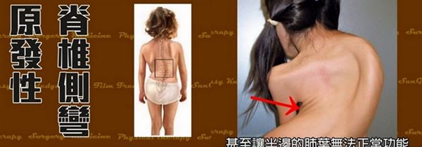 脊椎9.jpg