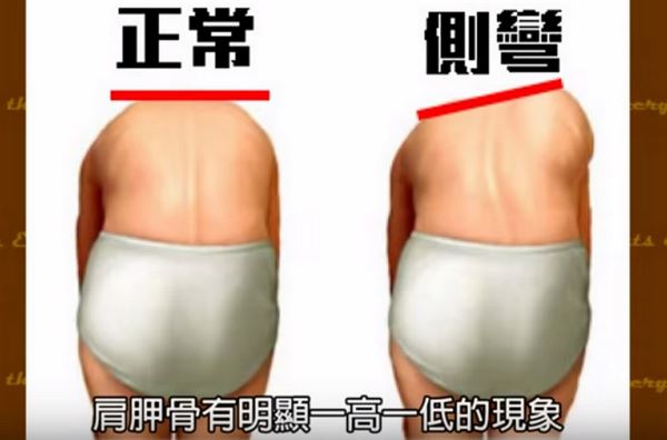 脊椎1.jpg