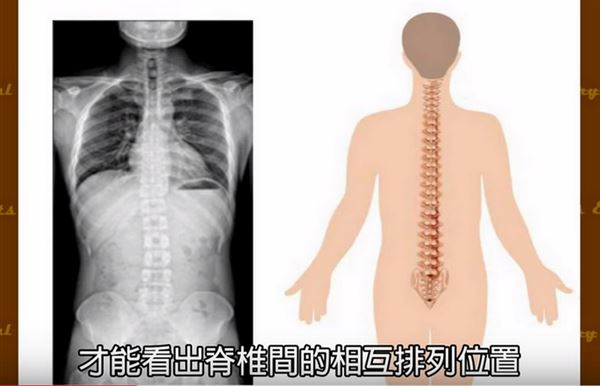 脊椎2.jpg