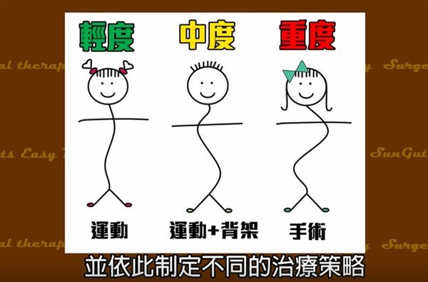 脊椎4.jpg