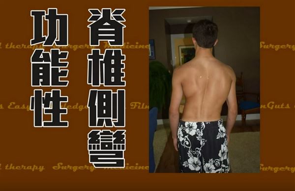脊椎5.jpg